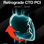 A guide to mastering Retrograde CTO PCI