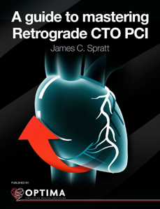 A guide to mastering Retrograde CTO PCI